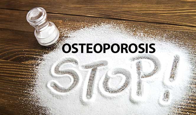 High-Salt Intake and Osteoporosis